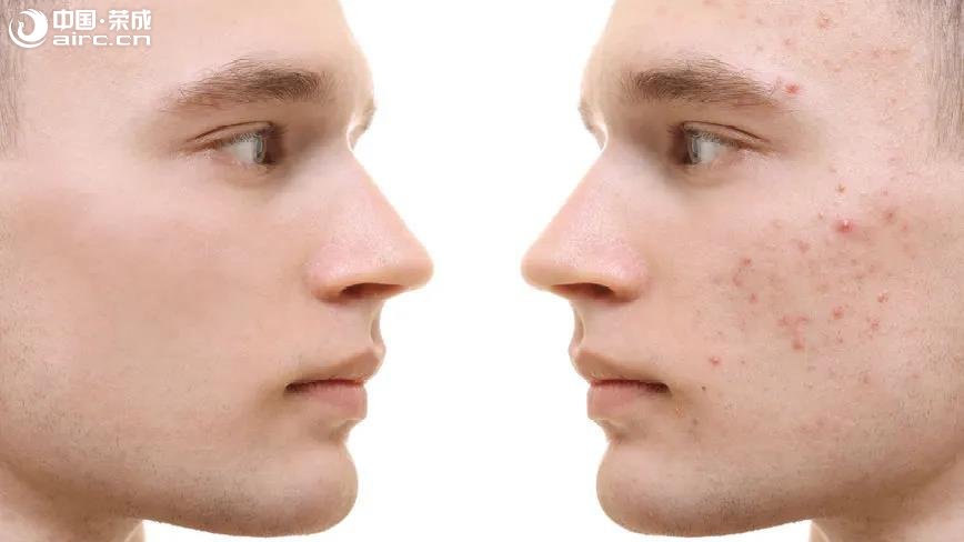 ĸỻЧô