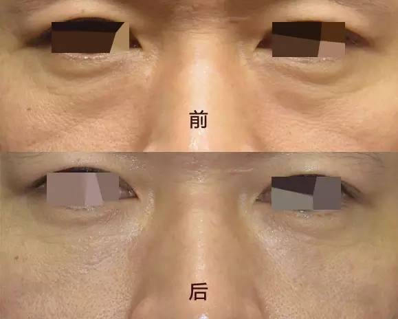 ٳ | УǸԲϻ۴Լûx