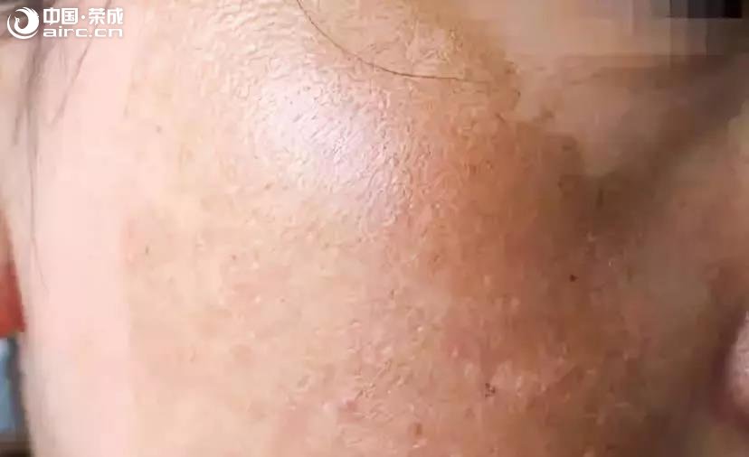ͼƬ
